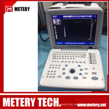 Scanner de diagnóstico por ultra-som série MT300V